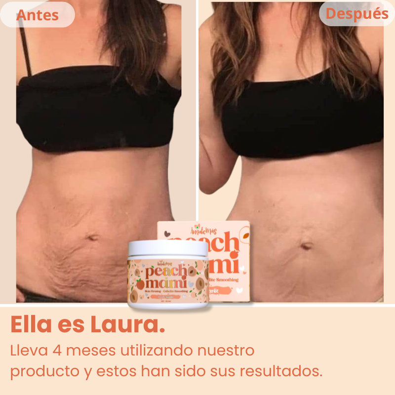 Zenvora™ Crema Rejuvenecedora de Durazno