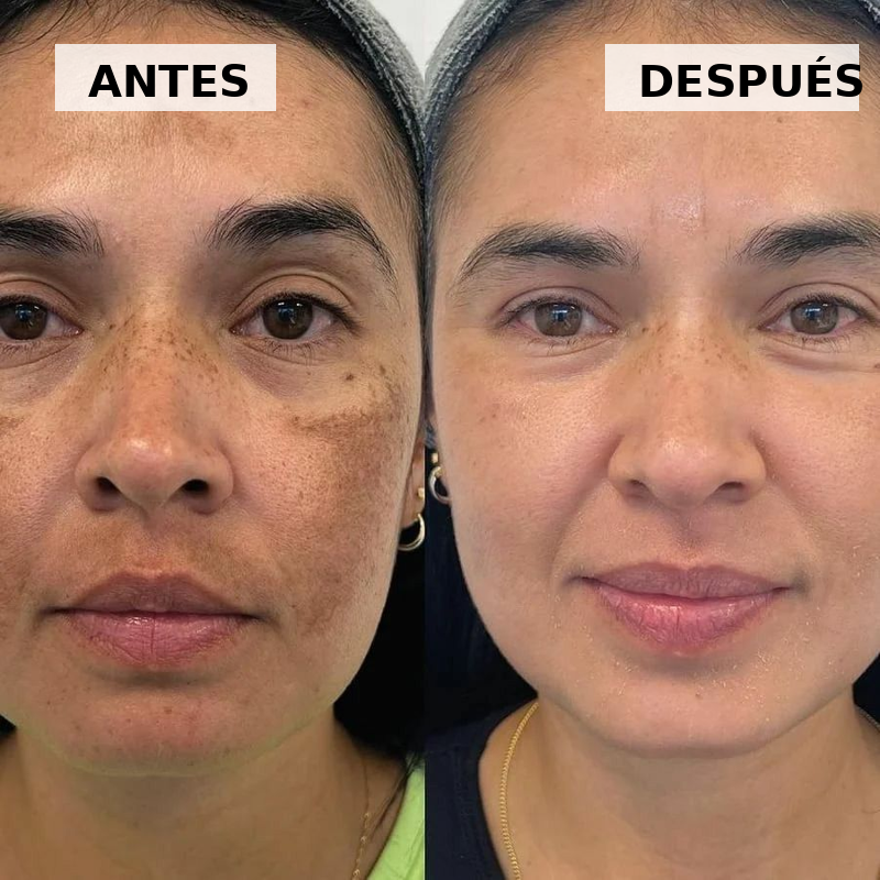 Zenvora™ Crema Antimanchas y Reafirmante