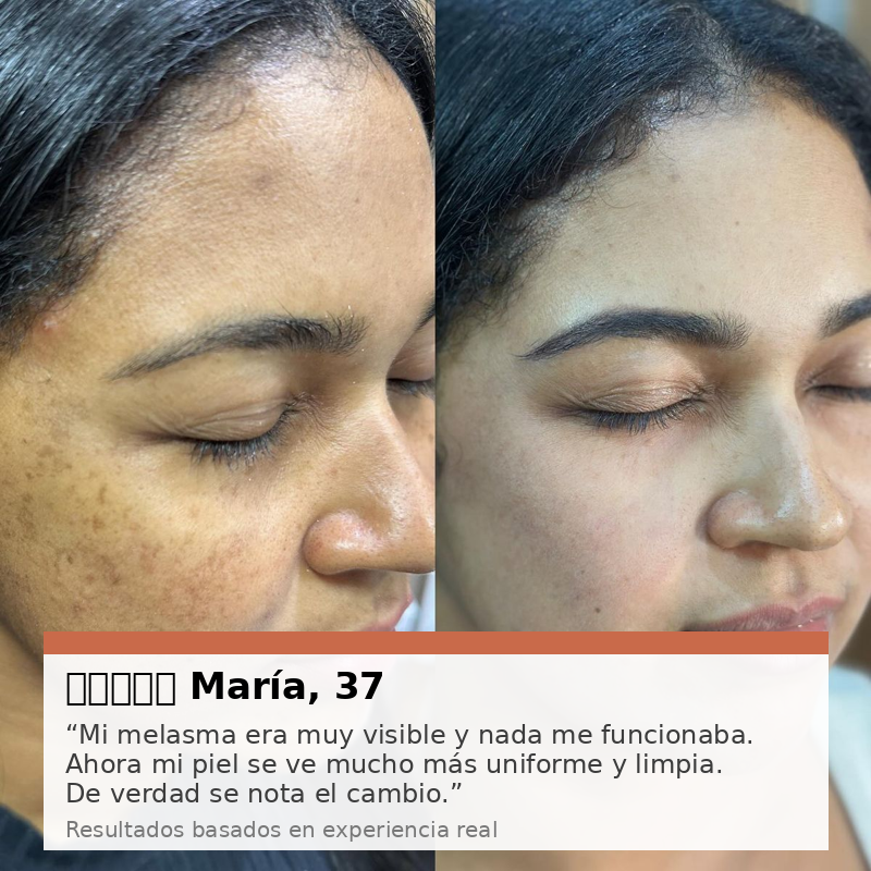 Zenvora™ Crema Antimanchas y Reafirmante